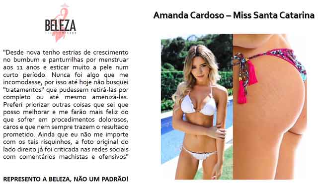 qacoesmodelo2